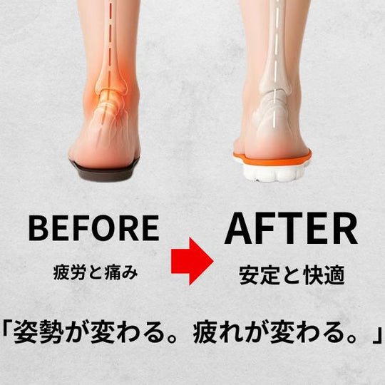 Over-Soles　マッサージインソール